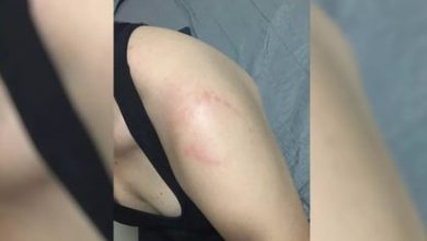 Photo of Homem é investigado por morder braço de mulher em academia de Rio Verde (GO)